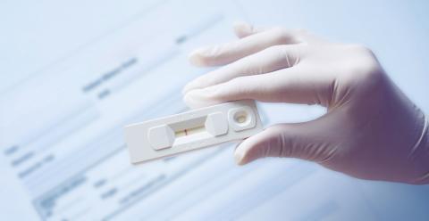 Test diagnostique du SARS-CoV2